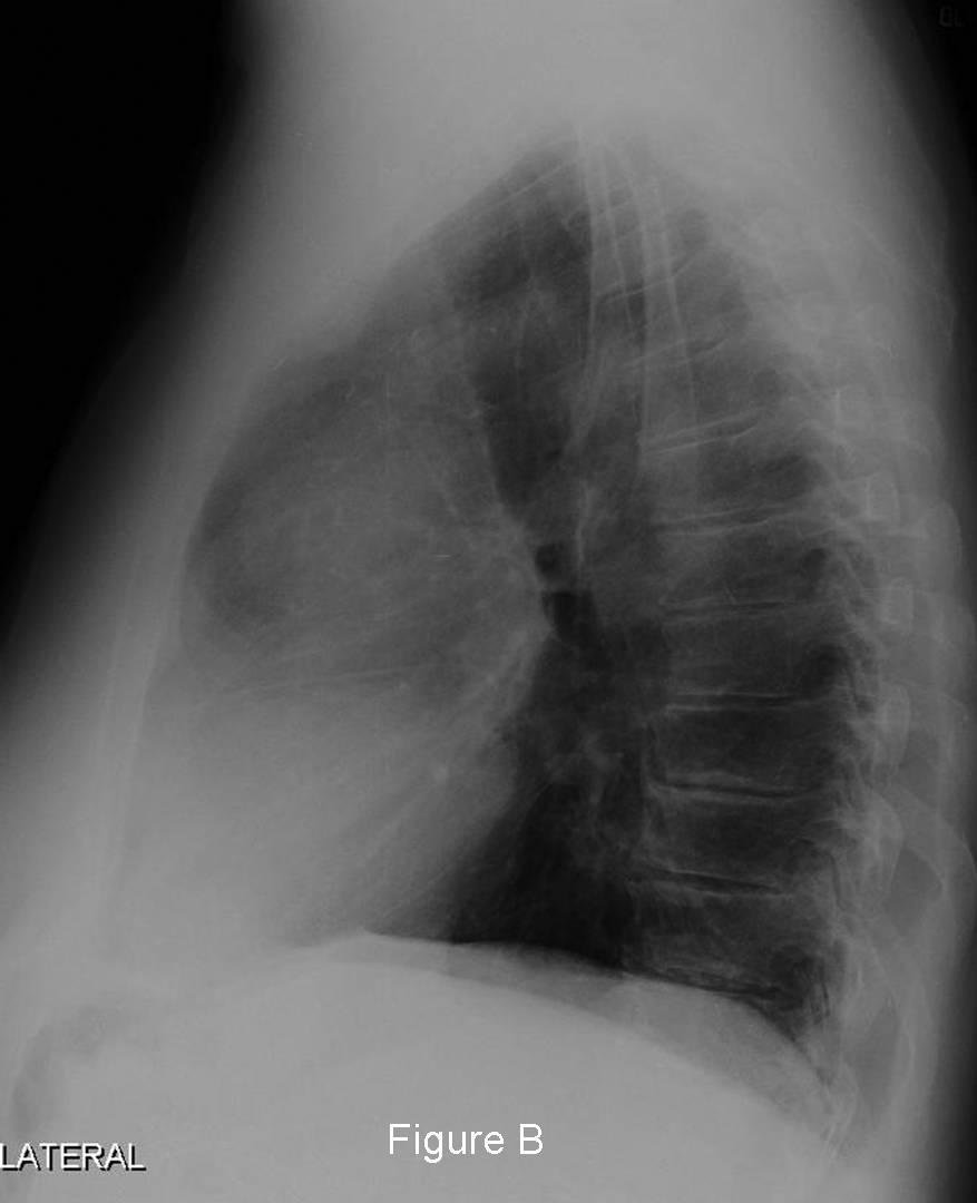 Radiograph 2 from archived case 46