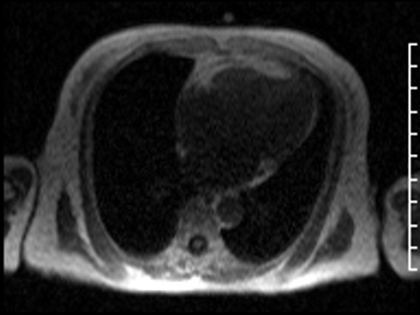 Radiograph 2 from archived case 61
