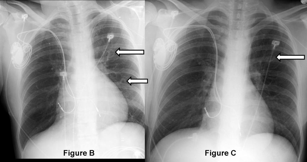 Radiograph 4 from archived case 59