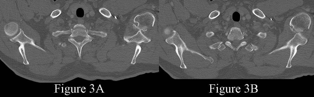 Radiograph 3 from archived case 65
