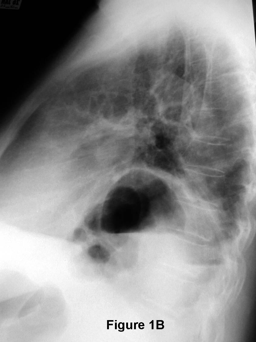 Radiograph 2 from archived case 76