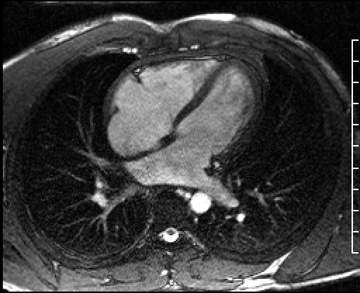 Radiograph 2 from archived case 38