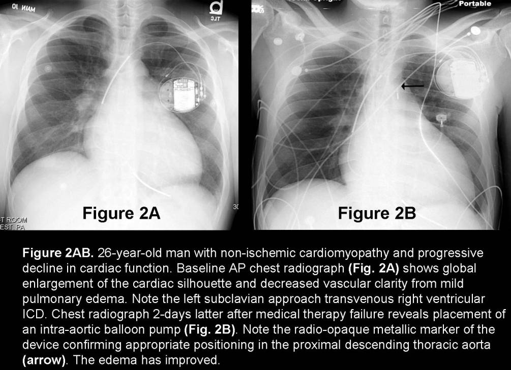 Radiograph 3 from archived case 53