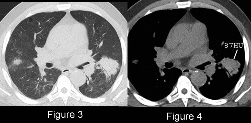 Radiograph 2 from archived case 56