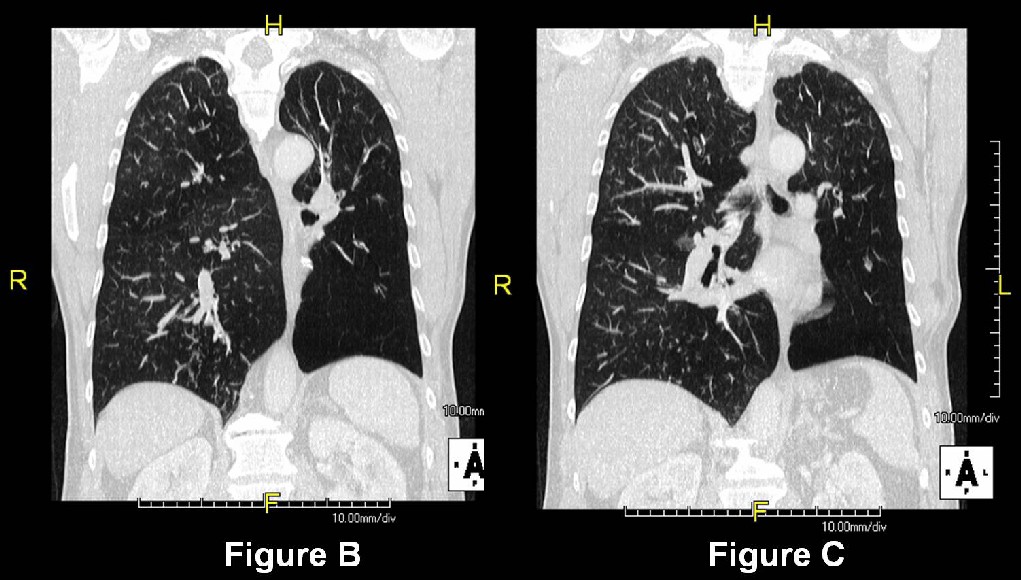 Radiograph 3 from archived case 36