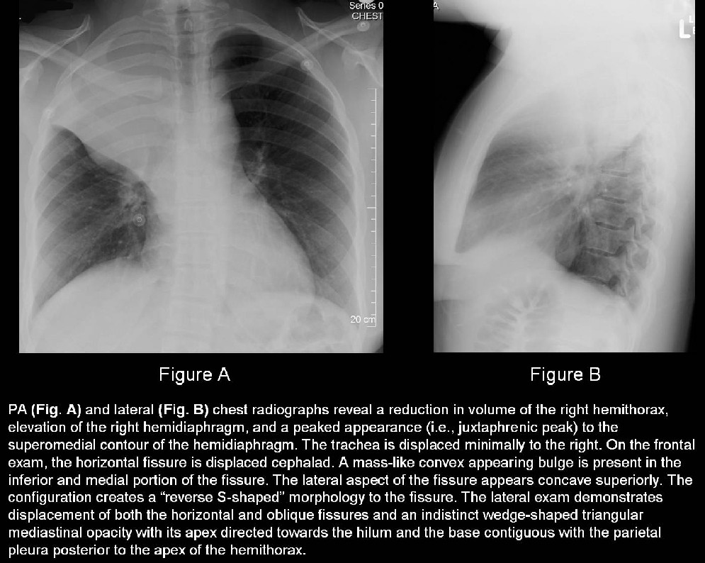 Radiograph 2 from archived case 24