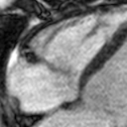 Radiograph 2 from archived case 30