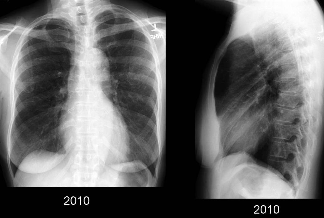 Radiograph 6 from archived case 49