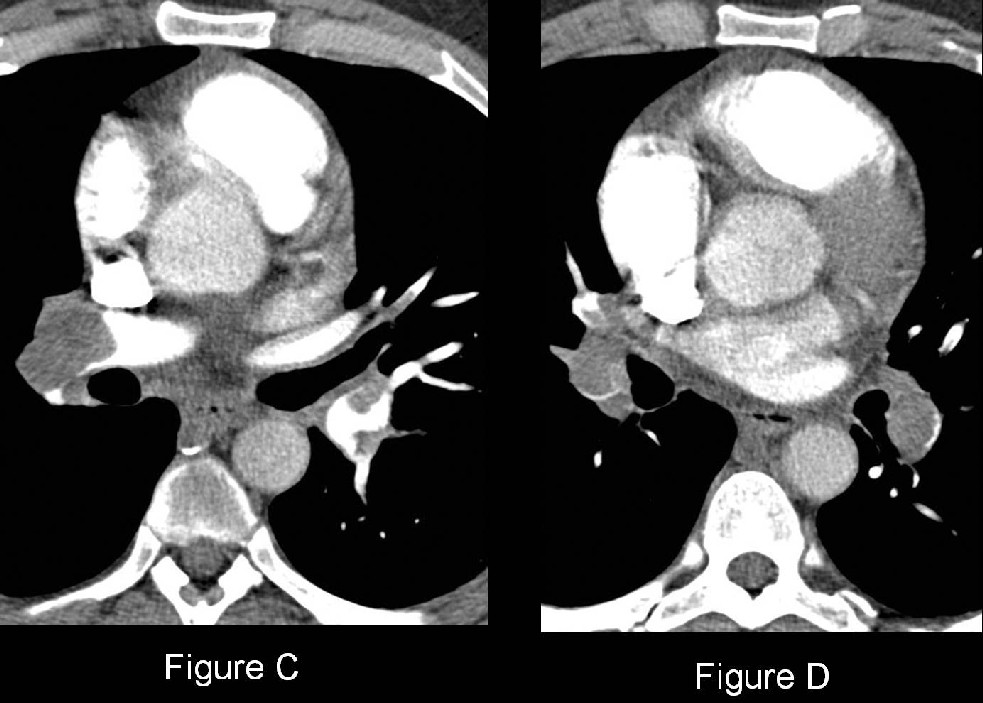 Radiograph 5 from archived case 41