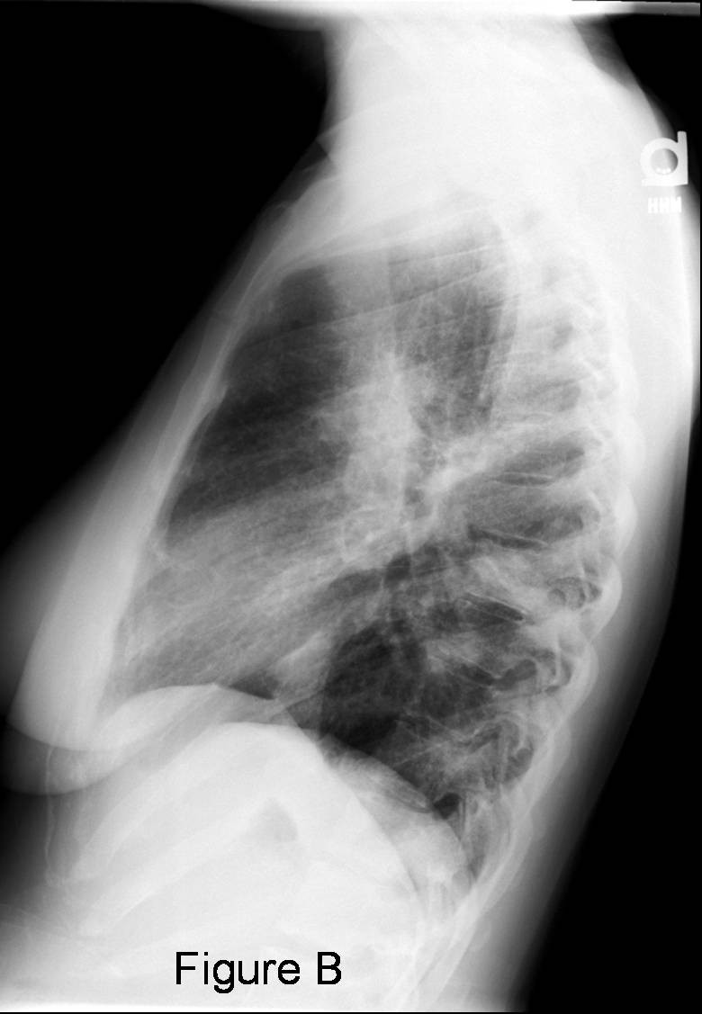 Radiograph 2 from archived case 23