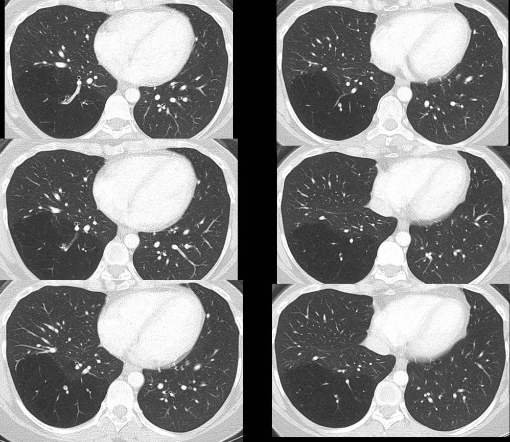 Radiograph 2 from archived case 54
