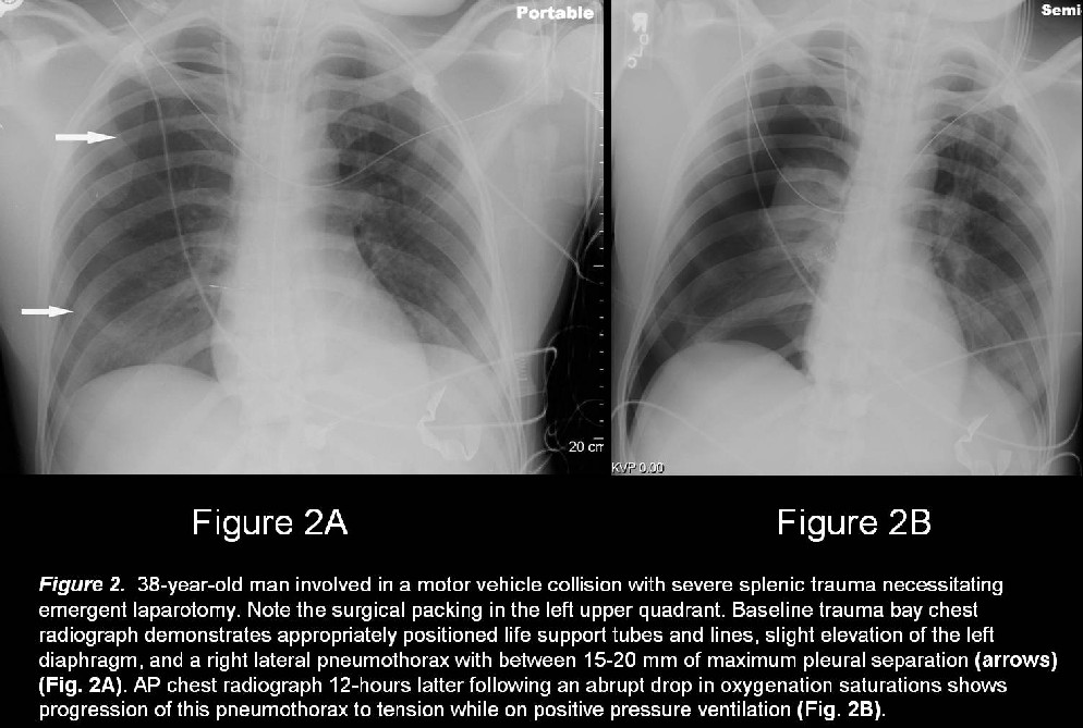 Radiograph 3 from archived case 34