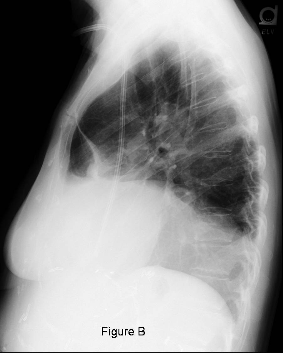 Radiograph 4 from archived case 44