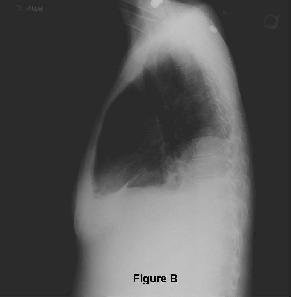 Radiograph 2 from archived case 32