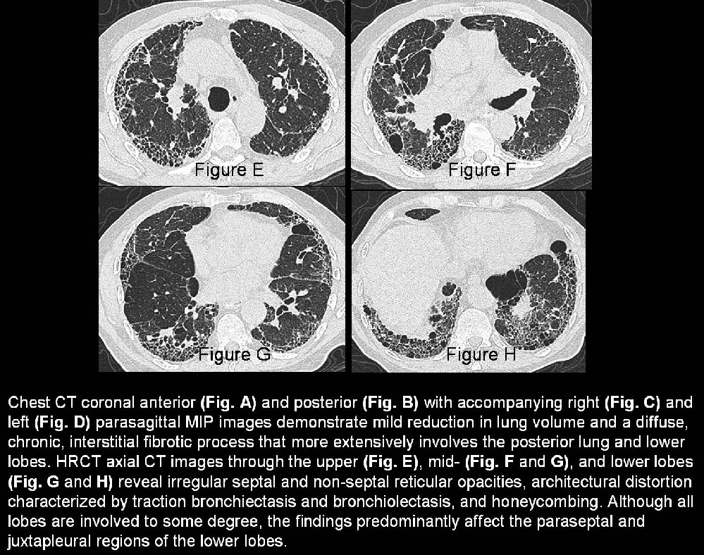Radiograph 4 from archived case 27