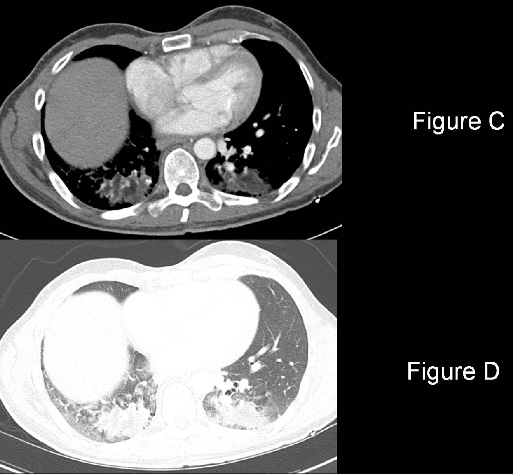 Radiograph 2 from archived case 14