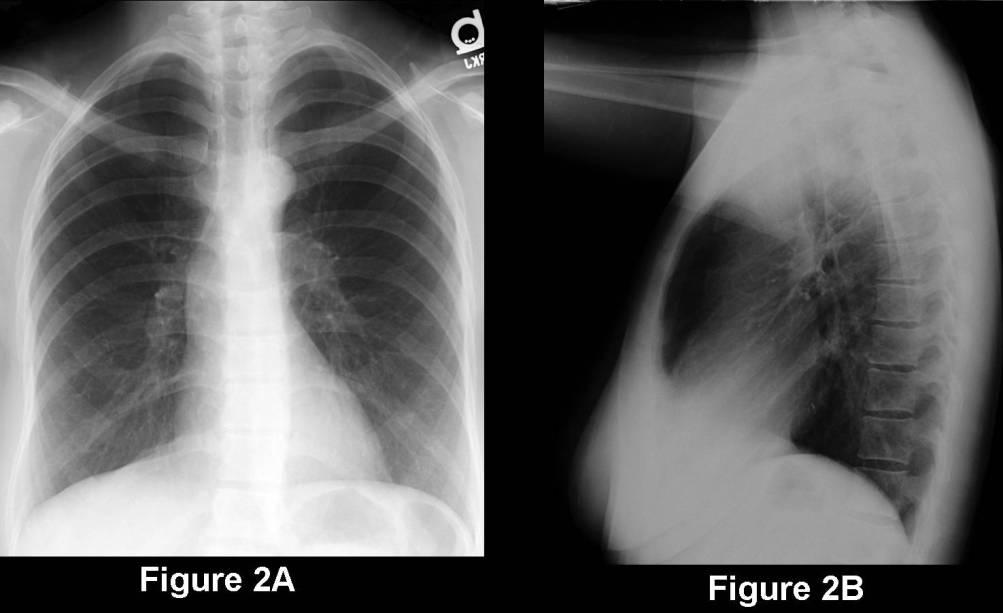 Radiograph 4 from archived case 67