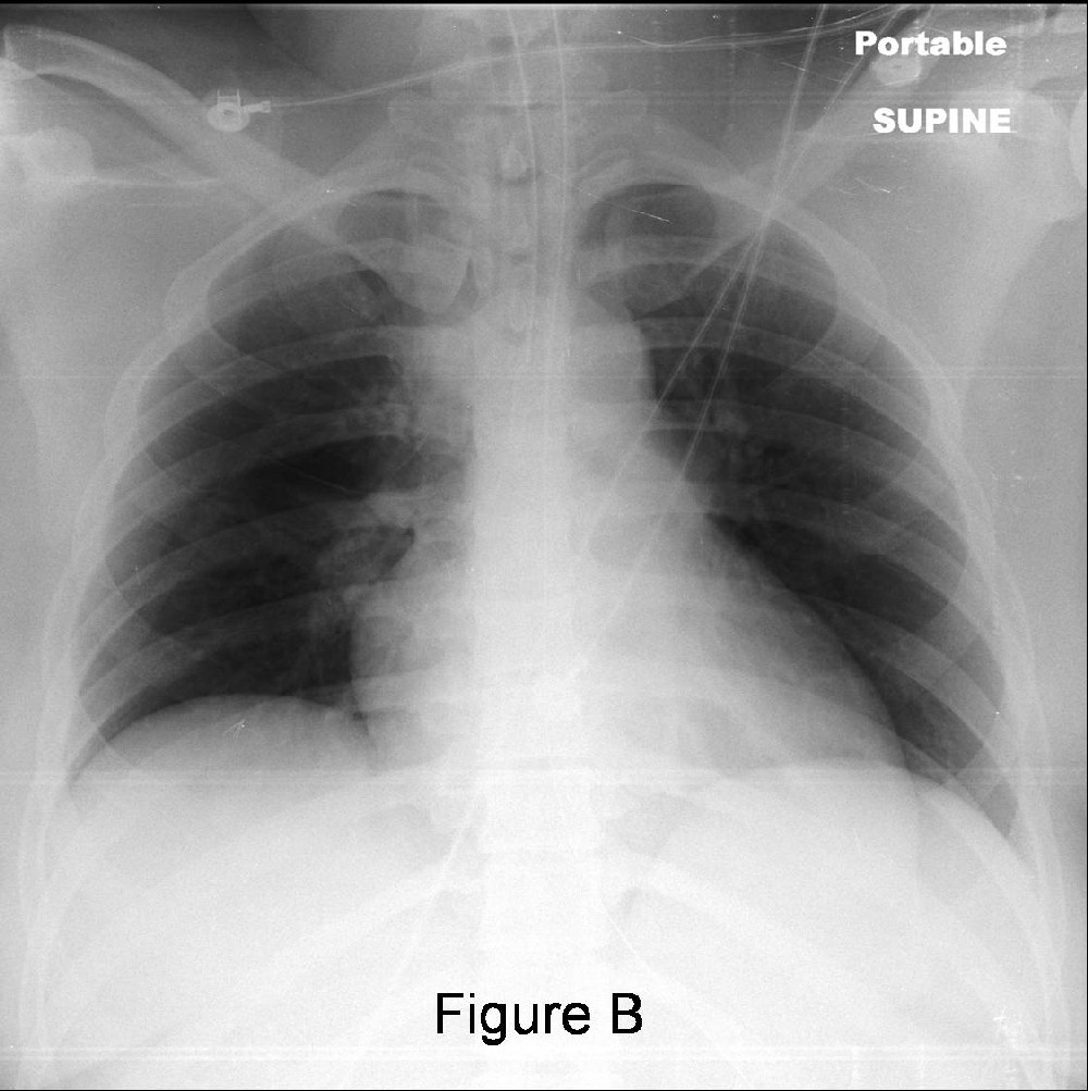 Radiograph 3 from archived case 39