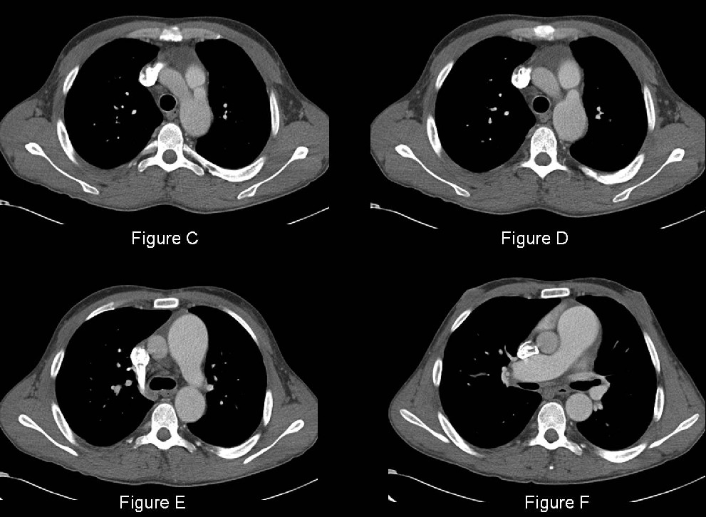 Radiograph 2 from archived case 40
