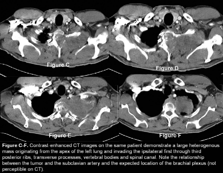 Radiograph 3 from archived case 28