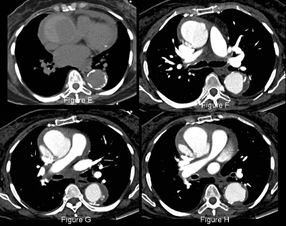 Radiograph 3 from archived case 25