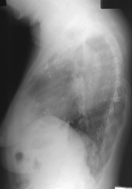 Radiograph 2 from archived case 29