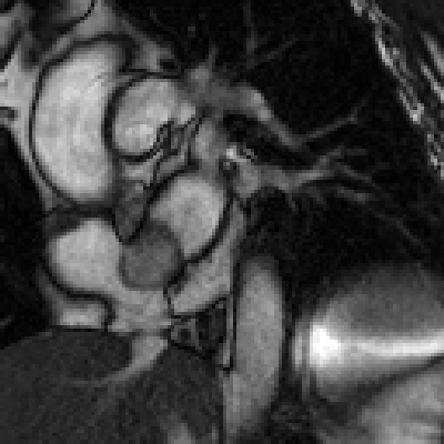 Radiograph 2 from archived case 20