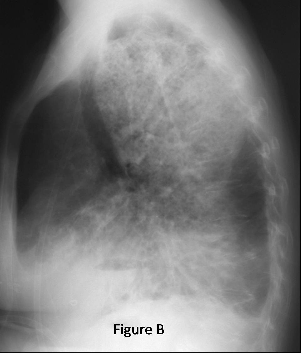 Radiograph 3 from archived case 43