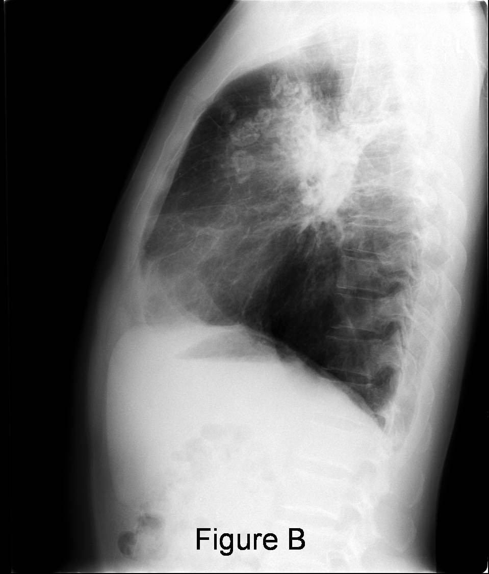 Radiograph 2 from archived case 21
