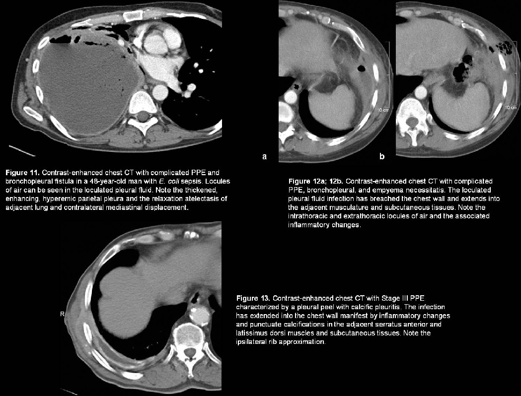 Radiograph 4 from archived case 5