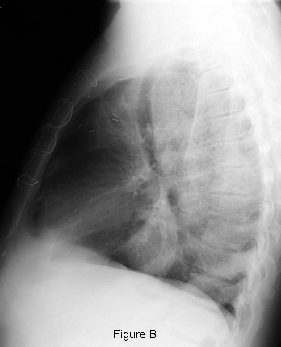 Radiograph 4 from archived case 45