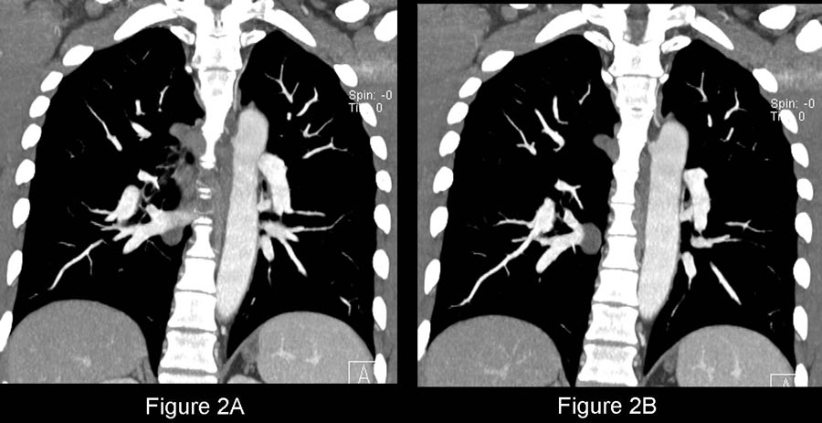 Radiograph 2 from archived case 66