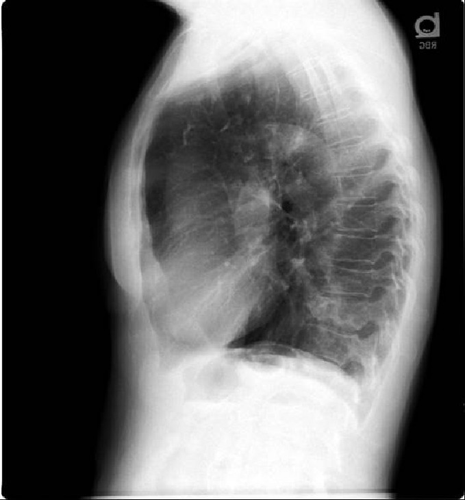 Radiograph 2 from archived case 11