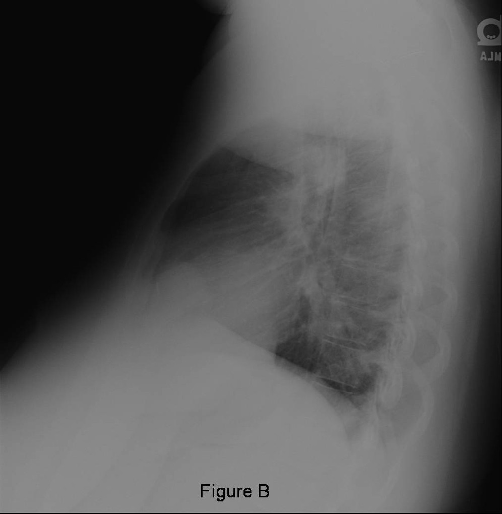 Radiograph 2 from archived case 33