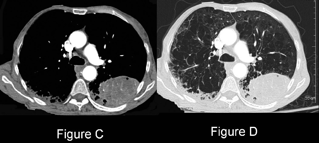 Radiograph 3 from archived case 13