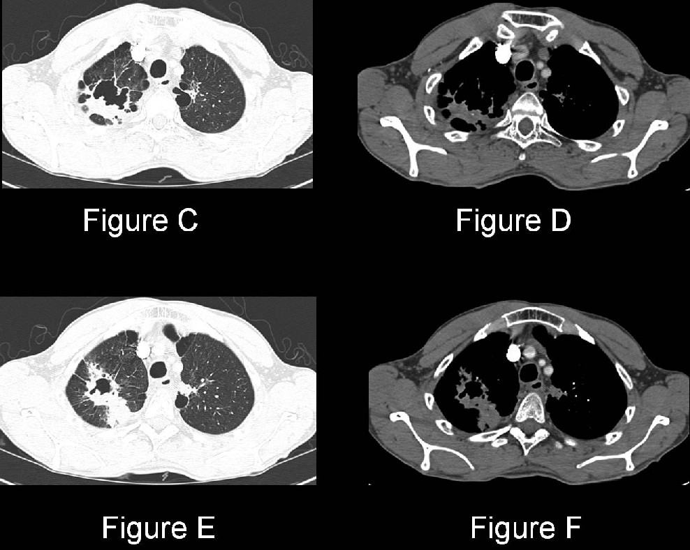 Radiograph 3 from archived case 16