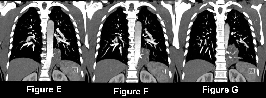 Radiograph 5 from archived case 18