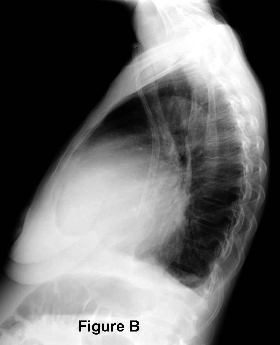 Radiograph 5 from archived case 52