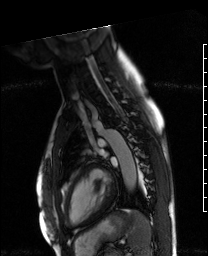 Radiograph 3 from archived case 72