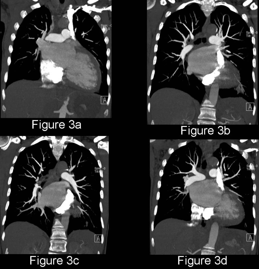 Radiograph 5 from archived case 75