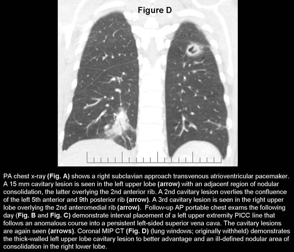Radiograph 5 from archived case 59