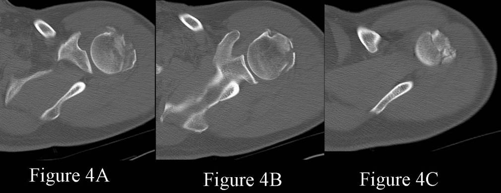 Radiograph 4 from archived case 65