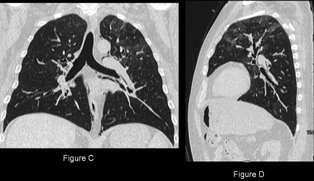 Radiograph 5 from archived case 37