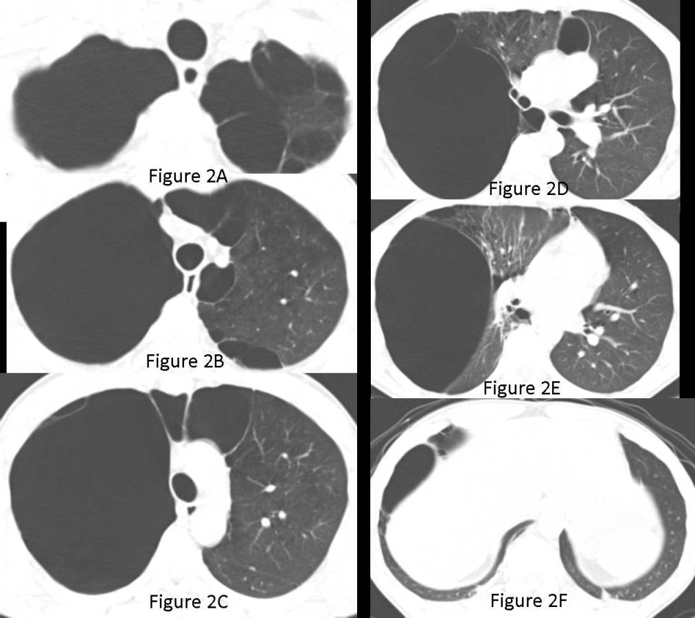 Radiograph 5 from archived case 70
