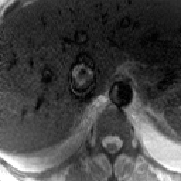 Radiograph 7 from archived case 30