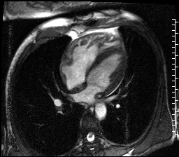 Radiograph 3 from archived case 69