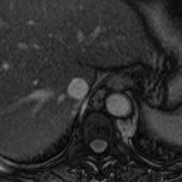 Radiograph 3 from archived case 51
