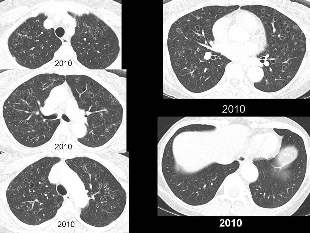 Radiograph 7 from archived case 49