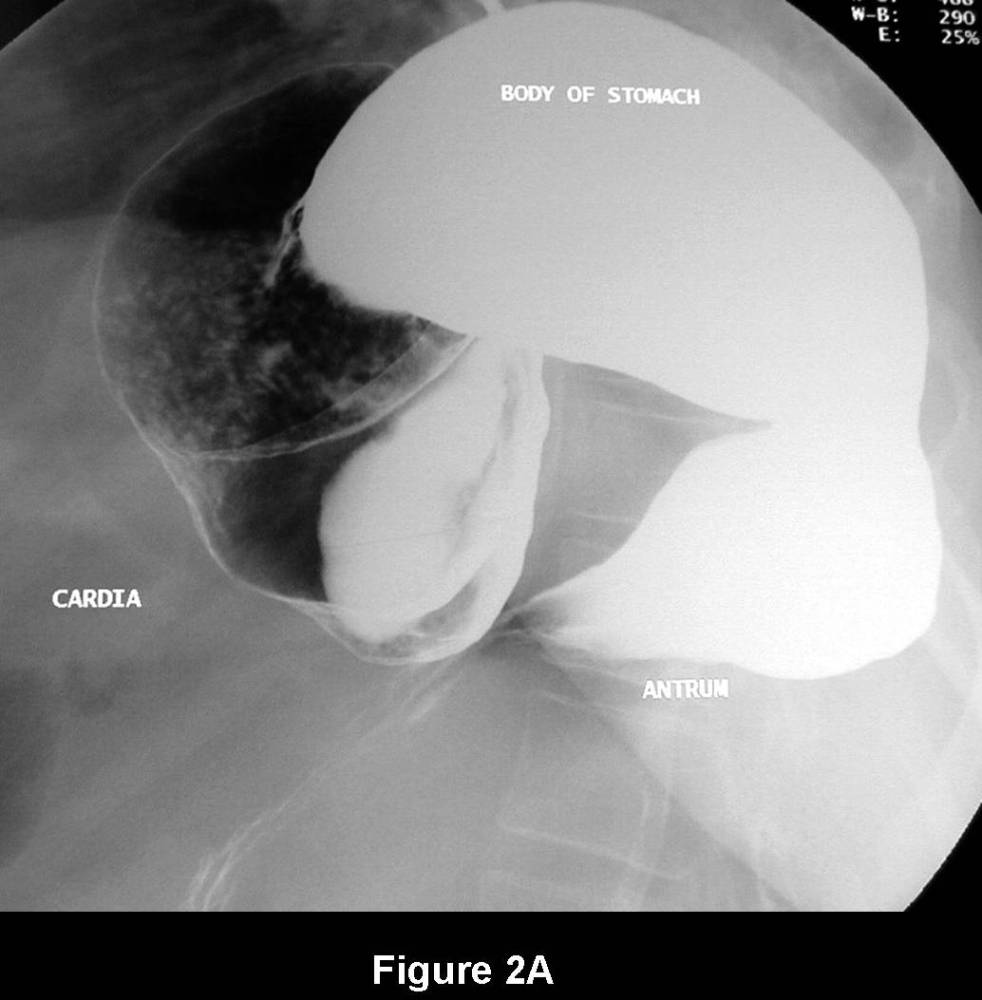 Radiograph 5 from archived case 76