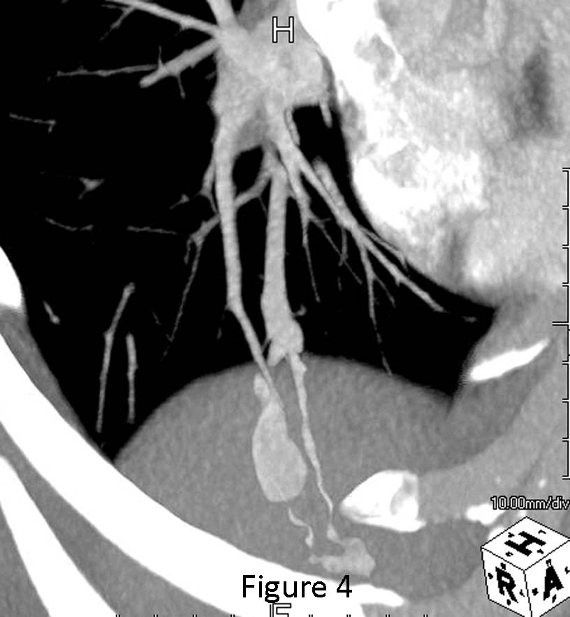 Radiograph 4 from archived case 71